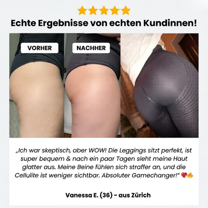 Nova Anti-Cellulite Leggings