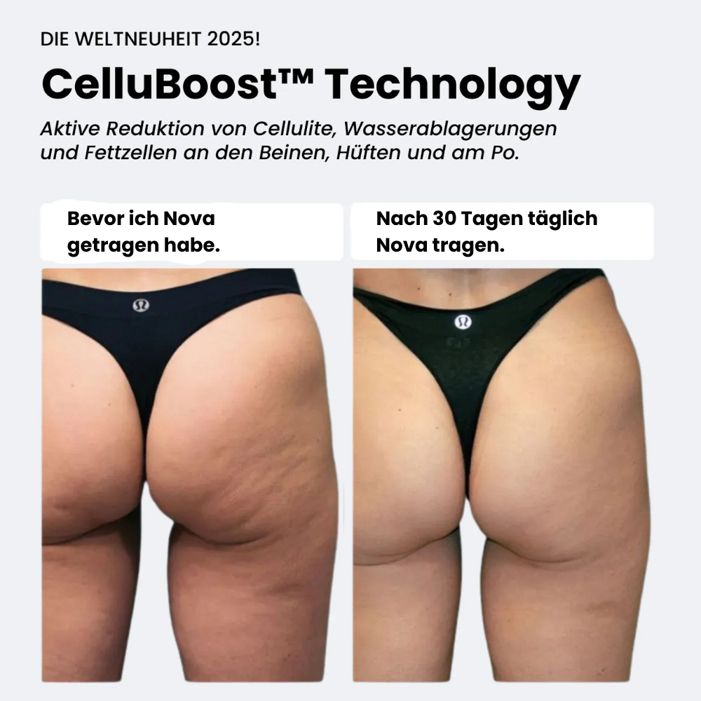 Nova Anti-Cellulite Leggings